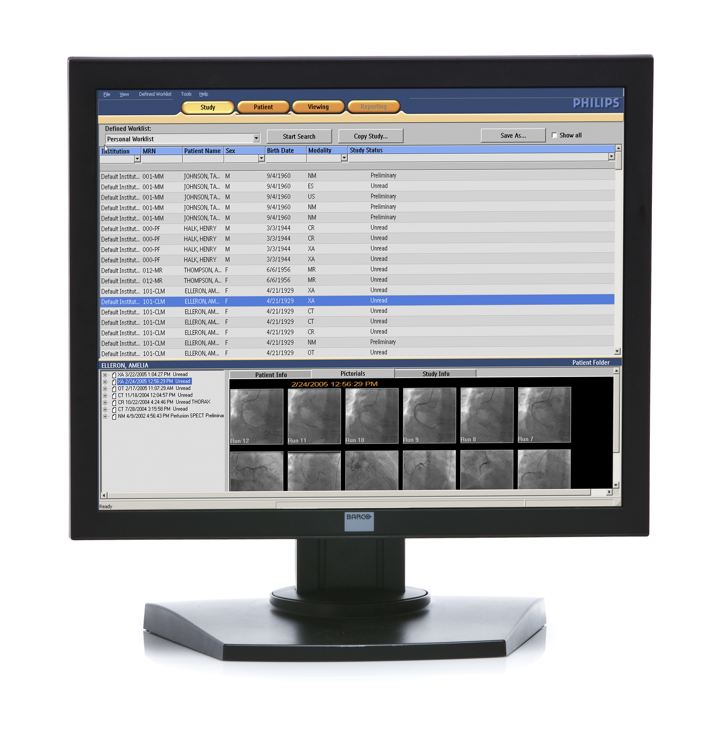 Screenshot of Xcelera Cardiology Enterprise viewer
