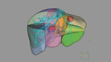 ct liver analysis
